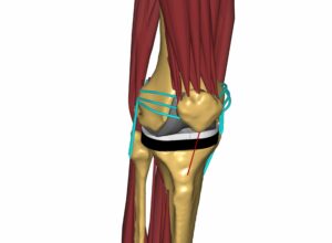Musculoskeletal knee model