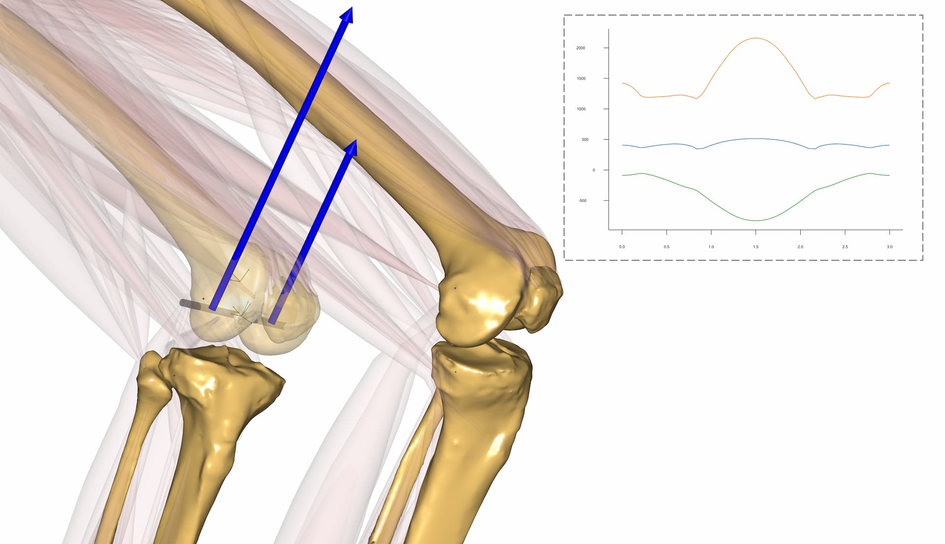 Knee biomechanics, joint, software, simulation