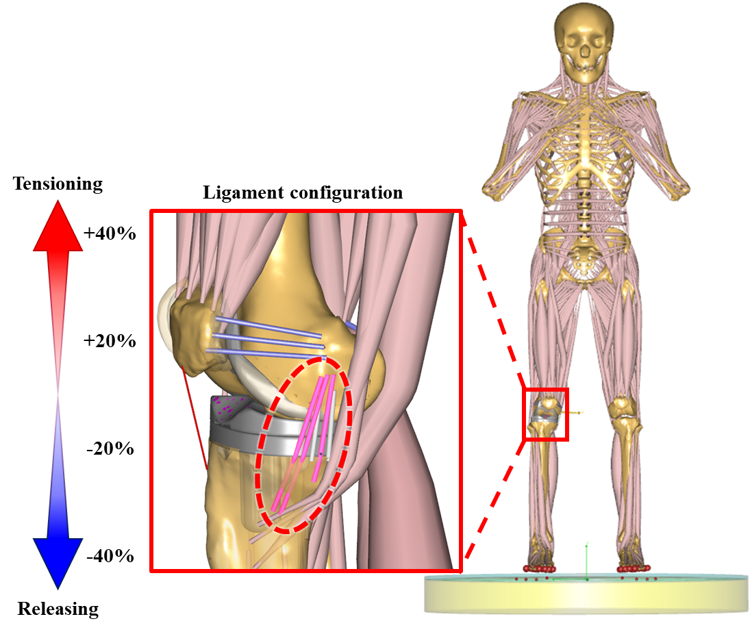 Impacts of ligament stiffness adjustment on knee joint mechanics in mechanically aligned PS-TKA